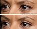 EasyLift The Original 60 Second Eye Lift | As Seen On TV | Lab Tested For Save Everyday Use | Made In the USA