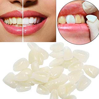 Teeth Veneers Ultra Thin Whitening Resin Anterior Upper Temporary C-rown Po-rcelain Oral Care 100 Pc - //medicalbooks.filipinodoctors.org