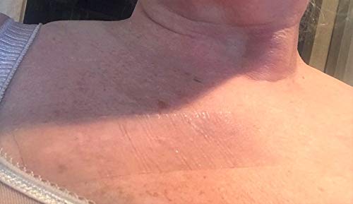 image for Silikan Tape Silikan Soft Premium Silicone Medical Grade Tape 1.6