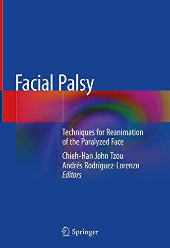 Facial Palsy: Techniques for Reanimation of the