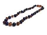 ADHD Raw Unpolished Baltic Amber Teething Necklace Babies (Cognac Brown) - Baby, Infant, and Toddlers will all benefit. Polished Anti Flammatory, Drooling & Teething Pain Reduce Properties - Natural Certificated Oval Baroque Round Baltic Jewelry with the Highest Quality Guaranteed. Easy to Fastens with a Twist-in Screw Clasp Mothers Approved Remedies! Helps some with stress, anxiety, colic, eczema, ADHD, acid reflux, GERD, gut issues, and heartburn. (Raw Coganc Lapis Lazuli)