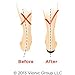 Vionic Men's Walker Classic Shoes
