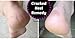 Dew Drops Miracle Hand and Foot Cream for Cracked Hands and feet