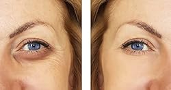 Verisol Collagen Bioactive Peptides