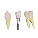 Annhua 4 Times Dental Implant Teeth Model Analysis Crown Bridge Demonstration Model, Dental Teeth Crown Roots Removable for Education, Patients Communication, Learning and Lab