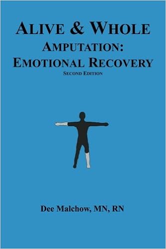 Alive Whole Amputationemotional Recovery 9781539012344 - 