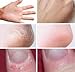 Dew Drops Miracle Hand and Foot Cream for Cracked Hands and feet