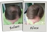 3D Hair Fibres 35g Medium Brown Keratin Protein for Thinning Hair Men Women view 7
