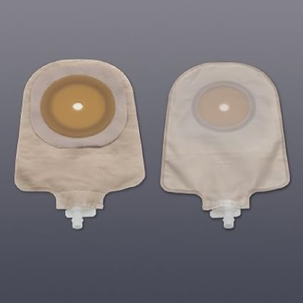 urostomy