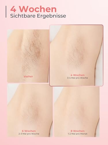 21J IPL Devices Hair Removal with 8°C Ice Cooling System, Laser Hair Removal 9 Levels & 600 NM Red Light, LCD Touch Screen IPL Hair Removal Device for Women Men, Face Arm Bikini Zone Body, Rose