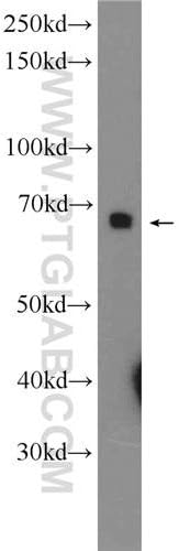 12109-1-AP - Size : 150 microliters - Anti-PTPN9 Rabbit Polyclonal Antibody - Each (150microliters)