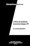 L'Affaire des prothèses mammaires toxiques PIP - Un scandale planétaire (Collection Votre Affaire M'intéresse t. 1) (French Edition) by