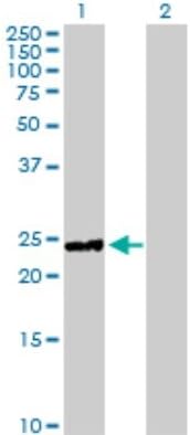 Hyaluronidase 1/HYAL1 Antibody