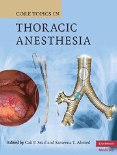 Download Core Topics in Thoracic Anesthesia PDF