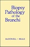 Biopsy Pathology of the Bronchi, McDowell, Elizabeth M. and Beals, Theodore F., 0030121191