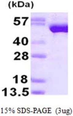 Recombinant Human Glutathione Reductase Protein