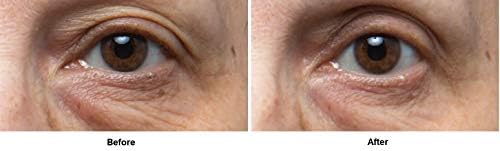 dr dennis gross eye serum before and after