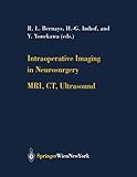 Intraoperative Imaging in Neurosurgery, , 321183835X