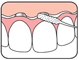 TePe Bridge & Implant Floss Brand TePe Dental Care Kit view 3