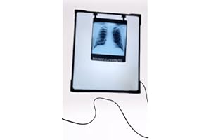 LED X-Ray View Box with Automatic Film Activation and Variable Brightness Control, White Size-14X17 Inch, Pack of 1