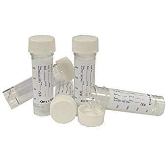 URINE SAMPLE WITH LABEL PK 25