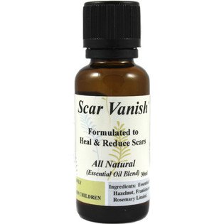 Scar Vanish Treatment (Essential Oil Blend) 30ml - All Natural formulated to heal and reduce scars