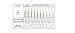 PUMA Cricket Kashmir Willow Bat (Evo Speed 2 KW Senior, Short Handle) by Yogi Sports