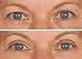 The New Eye Magic Instant Eye Lift (New Larger Shape)