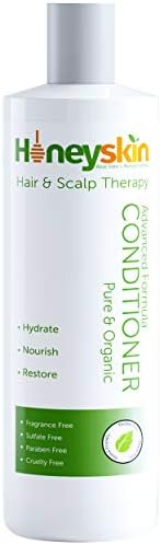 scalp eczema treatment