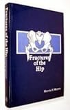 Fractures of the Hip, Meyers, Marvin H., 0815158971