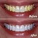 Glamology Herbal Whitening Neem Toothpaste, Fluoride-free, Antiplaque, Extreme Whitening Advanced gum Protection Toothpaste MADE From COCONUT, NEEM, CLOVE, GINSENG, BRAHMI, AMLA in Light (1 Pack)