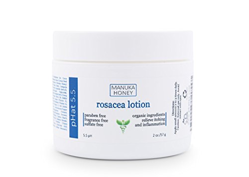 Rosacea Healing Cream - with Manuka Honey, Aloe Vera & Coconut Oil Extract - Redness & Inflammation Relief - Acne, Itch & Scar Treatment - Paraben & Sulfate Free (2oz)