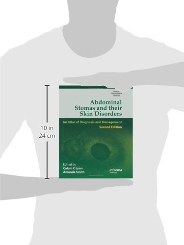 Abdominal Stomas and Their Skin Disorders (Series in Dermatological Treatment) - Thumbnail 2
