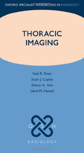 Thoracic Imaging (Paperback)