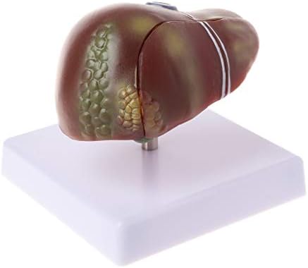 Huhudde Human Liver Pathological Anatomical Model Anatomy School Medical Teaching Display Tool Lab Equipment