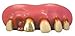 Billy Bob Gold Teeth 1 Pair, Style May Vary
