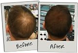 3D Hair Fibres 35g Medium Brown Keratin Protein for Thinning Hair Men Women view 8
