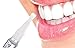 VS1 Teeth Whitening Pen, Whitening Treatments, No Sensitivity. MADE IN USA! 35% Carbamide Peroxide