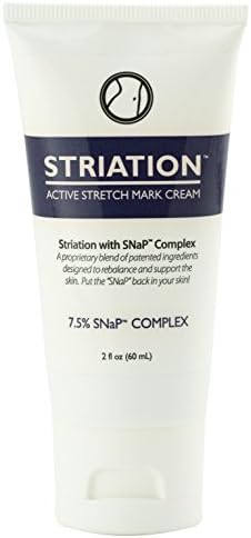Striation Active Stretch Mark Cream - Clinically Tested To Reduce Stretch Marks, Scars and Varicose Veins. Target Your Stomach, Arms, Butt and Thighs
