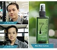 2 UNITS OF NEO LOTION GROW HAIR 120 ml.[Get Free Tomato Facial Mask & Ceramine UV Line Ginkgo Plus Whitening Cream 8.50ml.]