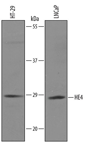 Human HE4/WFDC2 Antibody, 100 ug