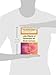 Late Effects of Treatment for Brain Tumors (Cancer Treatment and Research, 150)