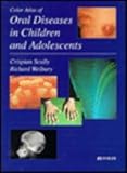 A Color Atlas of Oral Disease in Children, Scully, Crispian, 0815175892