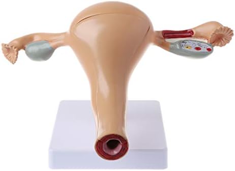 Watermk Human Pathological Uterus Ovary Model Anatomical Anatomy Disease Pathology Medical Lesion For Teaching