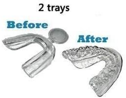 2 Teeth Tooth Mouth Whitening Thermoform Molding Fit Trays for Bleaching by PearlBrites