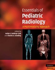 ESSENTIALS OF PEDIATRIC RADIOLOGY