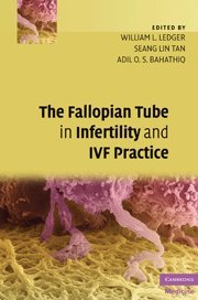 THE FALLOPIAN TUBE IN INFERTILITY AND IVF PRACTICE