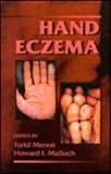 Hand Eczema, , 0849373557