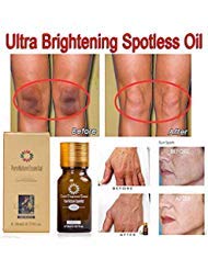 2 PCS Ultra Brightening Spotless Oil Dark Spots Removal Age Spots Hyper-Pigmentation
