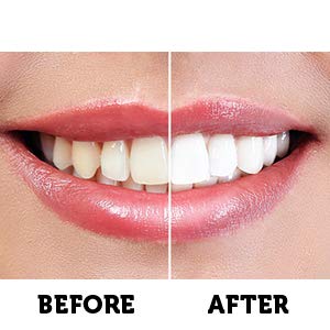 image for Active Wow Activated Charcoal Toothpaste - Teeth Whitening Formula wit